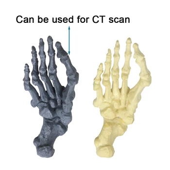 Два варианта тип Модел на човешкия скелет Модел эктропиона на палеца на Модел за корекция на деформация вальгусной
